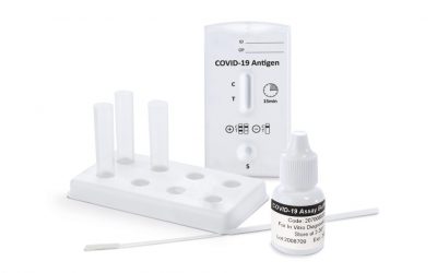 Biojam fornece um milhão de testes antigénio por semana a Portugal